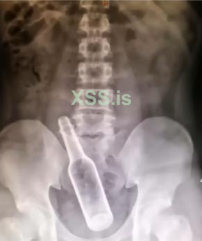 xray.jpg
